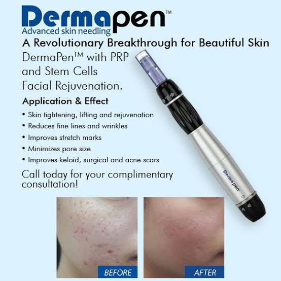 Derma Pen Treatment Images 27